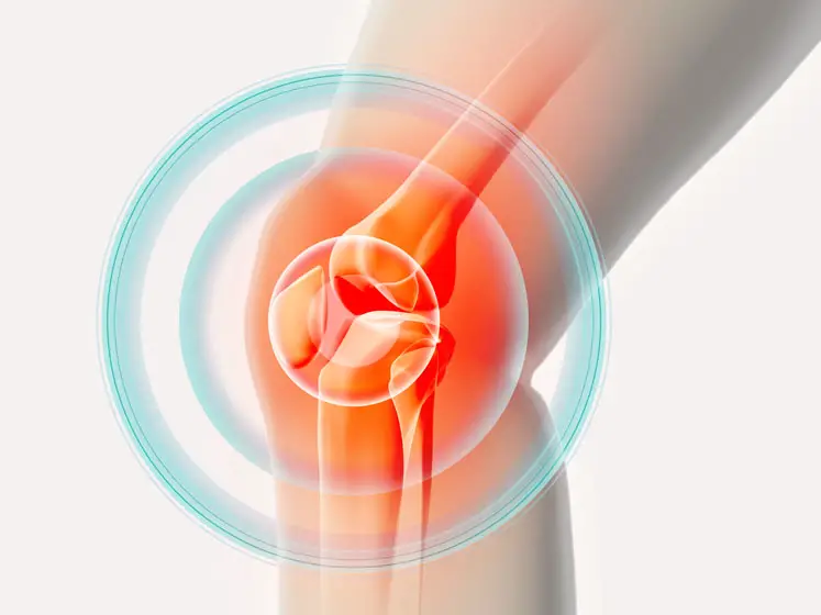 Bone and Joint Care